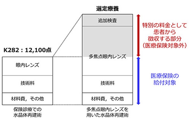 選定療養のイメージ